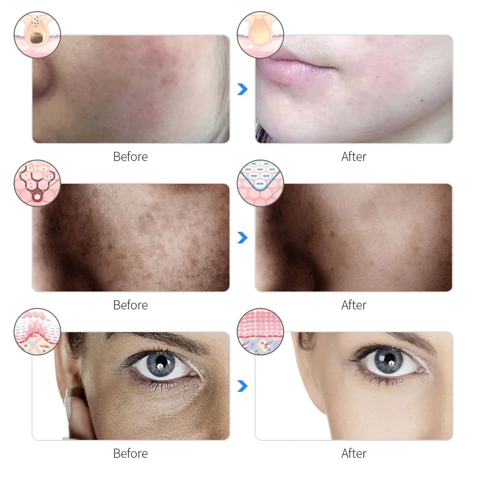 Masque Facial LED Rechargeable 7 Couleurs – Soin Anti-Âge, Éclat & Lifting à Domicile